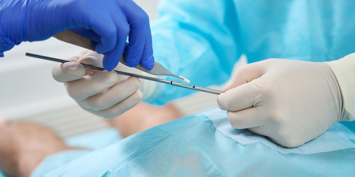 Pros and Cons of Hormone Pellets: A Comprehensive Guide