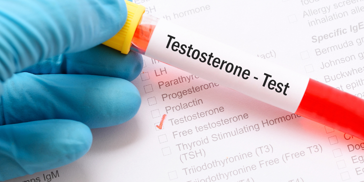 How To Test Testosterone Levels